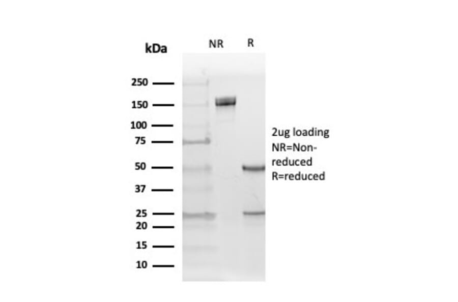 SDS-PAGE - Anti-Estrogen Receptor beta 5 Antibody [PPG5/25] (A248489) - Antibodies.com
