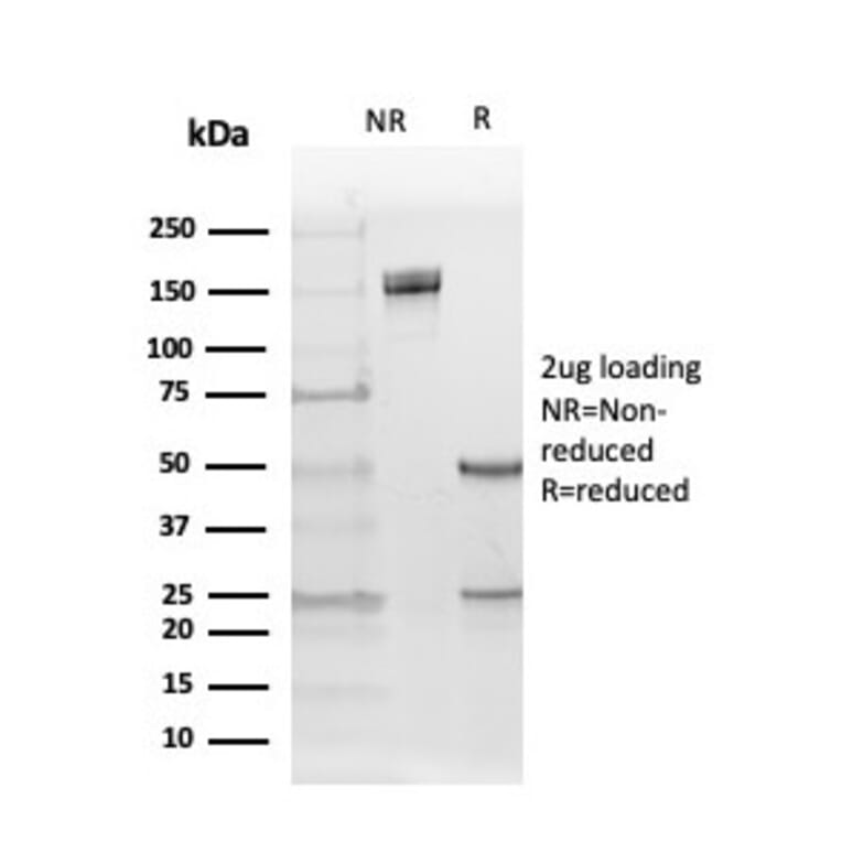 SDS-PAGE - Anti-Estrogen Receptor beta 5 Antibody [PPG5/25] (A248489) - Antibodies.com
