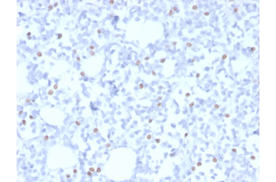 Immunohistochemistry - Anti-Estrogen Receptor beta 5 Antibody [PPG5/25] (A248488) - Antibodies.com