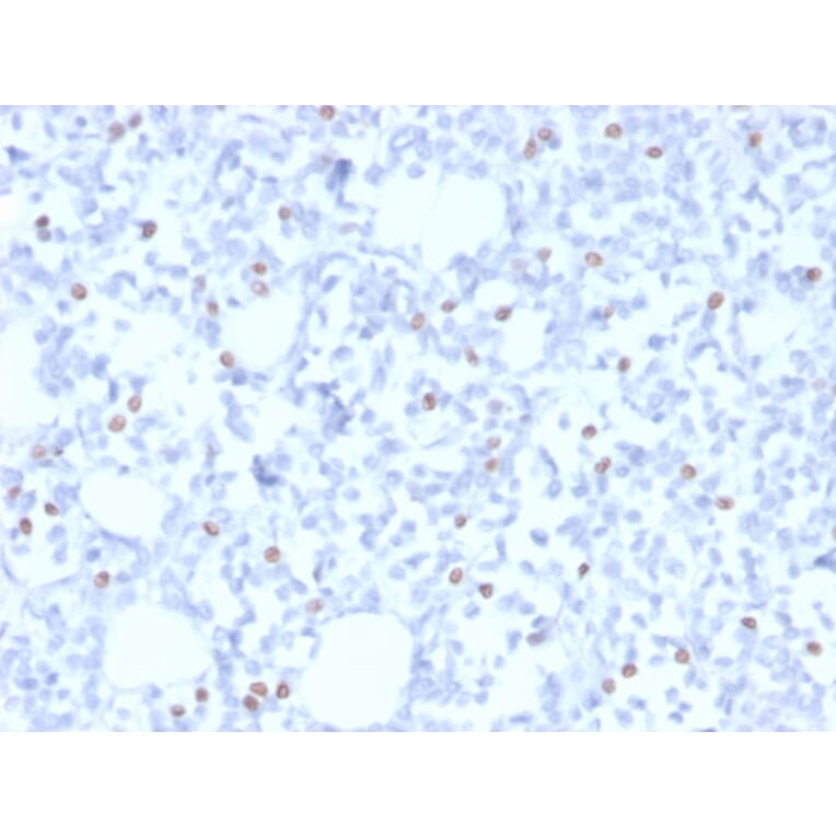 Immunohistochemistry - Anti-Estrogen Receptor beta 5 Antibody [PPG5/25] (A248488) - Antibodies.com