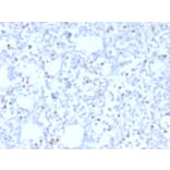 Immunohistochemistry - Anti-Estrogen Receptor beta 5 Antibody [PPG5/25] (A248488) - Antibodies.com