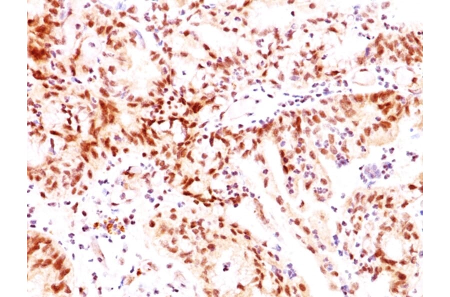 Immunohistochemistry - Anti-Estrogen Receptor beta 1 Antibody [ERb455] (A248490) - Antibodies.com
