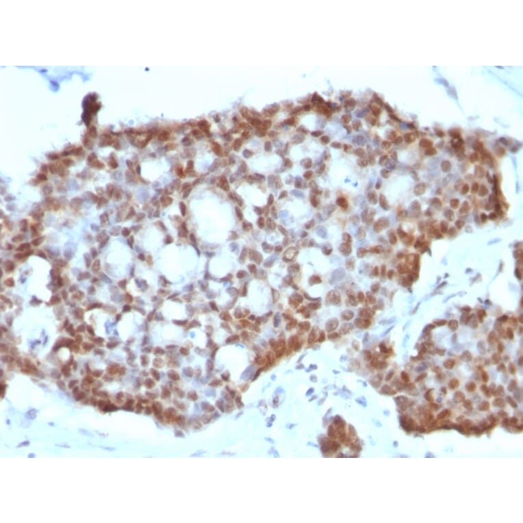 Immunohistochemistry - Anti-Estrogen Receptor beta 1 Antibody [ERb455] (A248490) - Antibodies.com