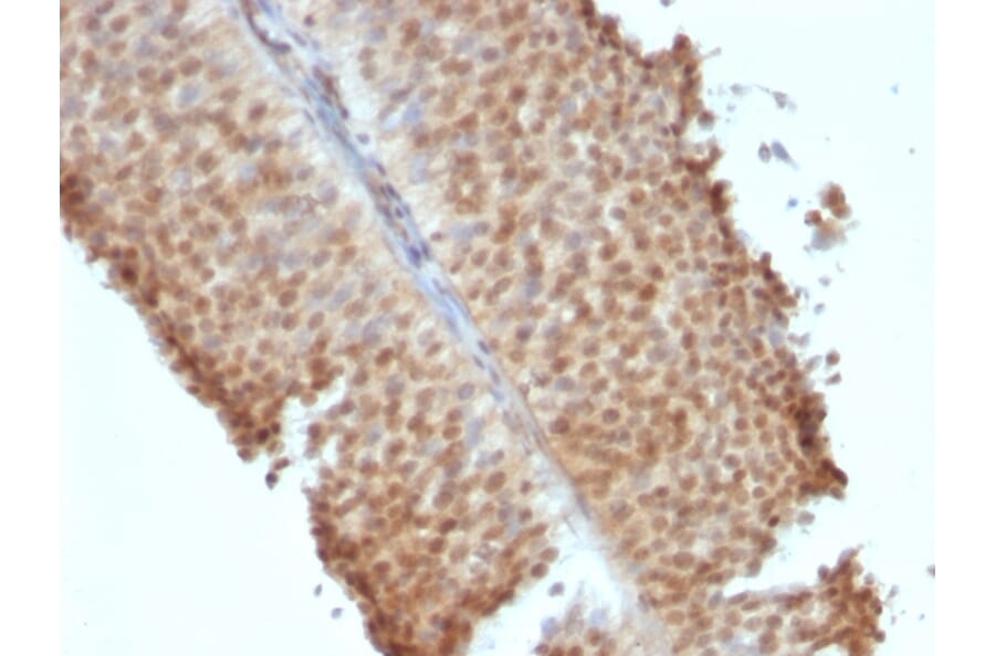 Immunohistochemistry - Anti-Estrogen Receptor beta 1 Antibody [ERb455] (A248490) - Antibodies.com