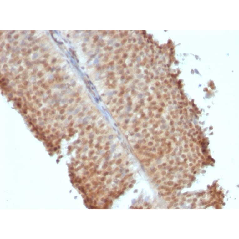 Immunohistochemistry - Anti-Estrogen Receptor beta 1 Antibody [ERb455] (A248490) - Antibodies.com