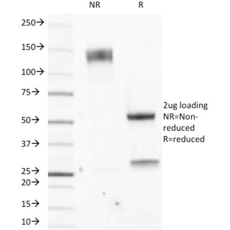 SDS-PAGE - Anti-Estrogen Receptor beta 1 Antibody [ERb455] (A248490) - Antibodies.com