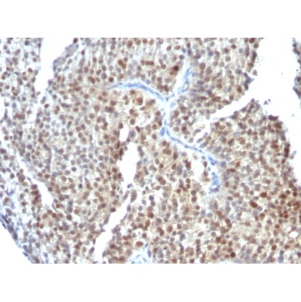 Immunohistochemistry - Anti-Estrogen Receptor beta 1 Antibody [ESR2/686] (A248491) - Antibodies.com