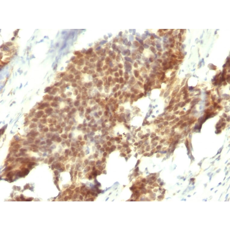Immunohistochemistry - Anti-Estrogen Receptor beta 1 Antibody [ESR2/686] (A248491) - Antibodies.com