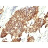 Immunohistochemistry - Anti-Estrogen Receptor beta 1 Antibody [ESR2/686] (A248491) - Antibodies.com