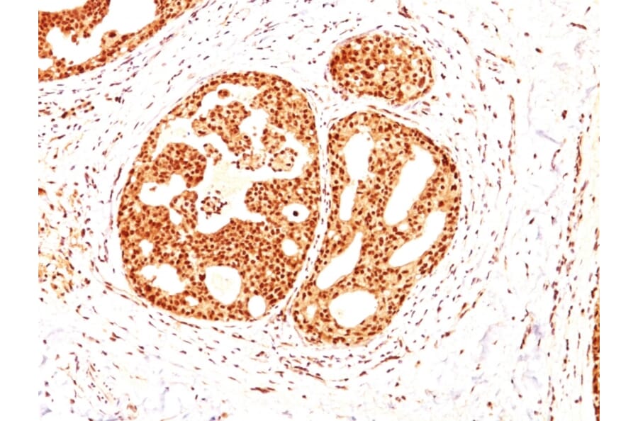 Immunohistochemistry - Anti-Estrogen Receptor beta 1 Antibody [ESR2/686] (A248491) - Antibodies.com