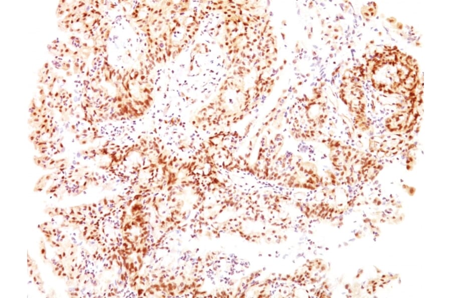 Immunohistochemistry - Anti-Estrogen Receptor beta 1 Antibody [ESR2/686] (A248491) - Antibodies.com
