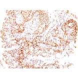 Immunohistochemistry - Anti-Estrogen Receptor beta 1 Antibody [ESR2/686] (A248491) - Antibodies.com