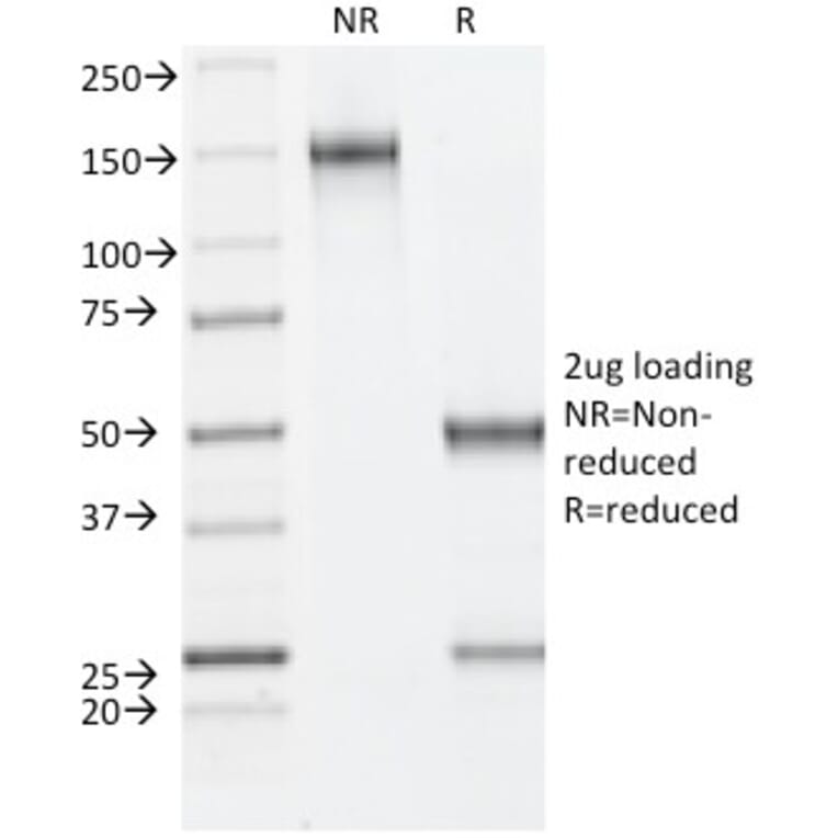 SDS-PAGE - Anti-Estrogen Receptor beta 1 Antibody [ESR2/686] (A248491) - Antibodies.com