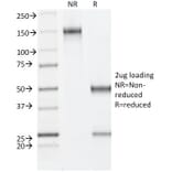 SDS-PAGE - Anti-Estrogen Receptor beta 1 Antibody [ESR2/686] (A248491) - Antibodies.com
