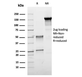 SDS-PAGE - Anti-Estrogen Receptor beta 1 Antibody [ESR2/3005] (A248492) - Antibodies.com