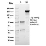 SDS-PAGE - Anti-Estrogen Receptor beta 1 Antibody [ESR2/3005] (A248492) - Antibodies.com