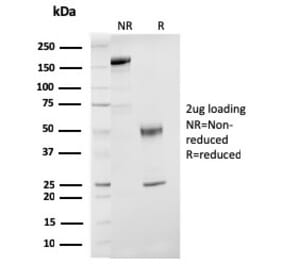 SDS-PAGE - Anti-Estrogen Receptor beta 1 Antibody [ESR2/3207] (A248493) - Antibodies.com