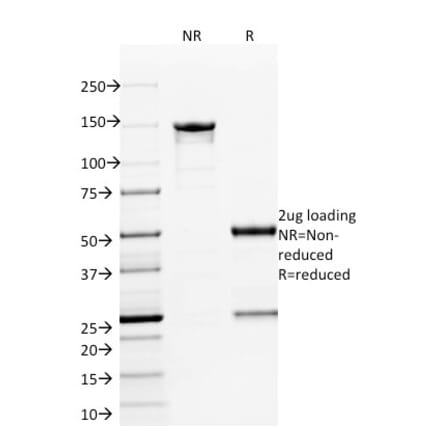 SDS-PAGE - Anti-ETS1 Antibody [ETS1/1801] (A248494) - Antibodies.com