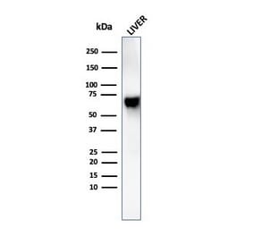 Western Blot - Anti-Albumin Antibody [rALB/6410] (A248495) - Antibodies.com