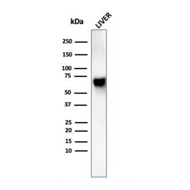 Western Blot - Anti-Albumin Antibody [rALB/6410] (A248495) - Antibodies.com