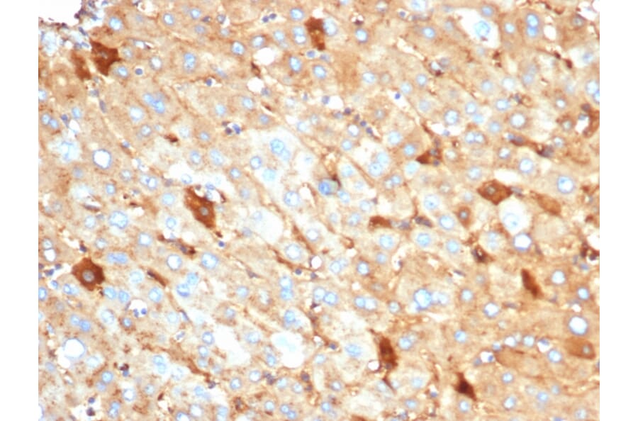 Immunohistochemistry - Anti-Albumin Antibody [rALB/6410] (A248494) - Antibodies.com