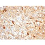 Immunohistochemistry - Anti-Albumin Antibody [rALB/6410] (A248494) - Antibodies.com
