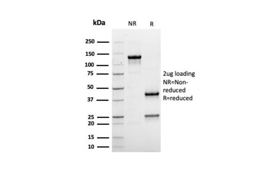 SDS-PAGE - Anti-Albumin Antibody [rALB/6410] (A248495) - Antibodies.com