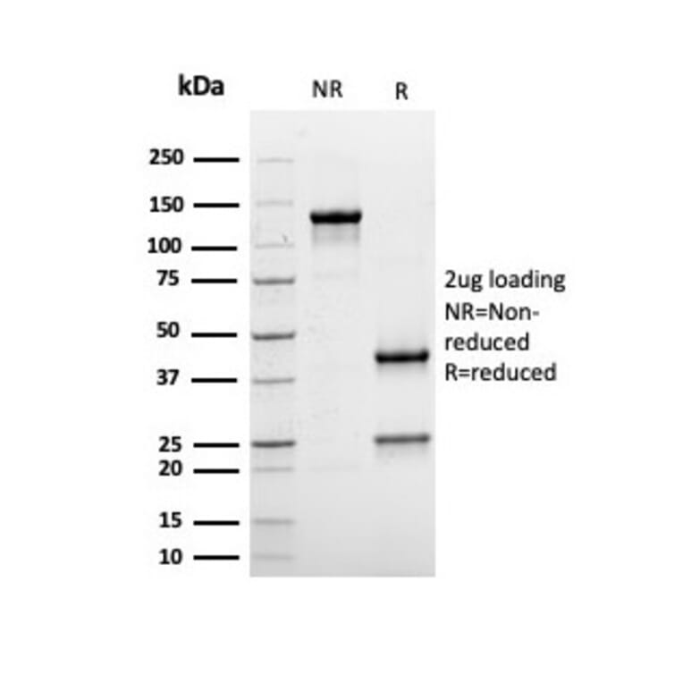 SDS-PAGE - Anti-Albumin Antibody [rALB/6410] (A248495) - Antibodies.com