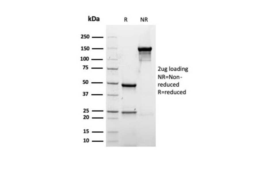 SDS-PAGE - Anti-Albumin Antibody [rALB/6412] (A248496) - Antibodies.com