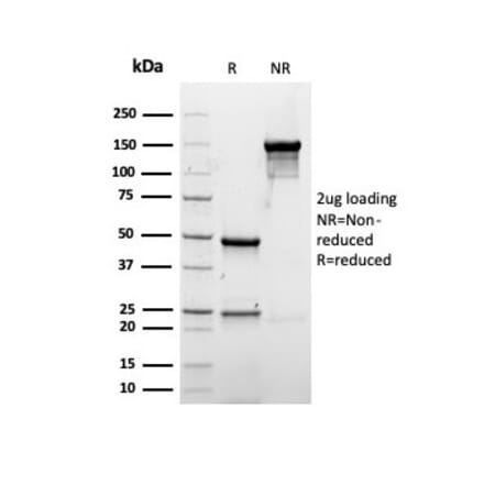 SDS-PAGE - Anti-Albumin Antibody [rALB/6412] (A248496) - Antibodies.com