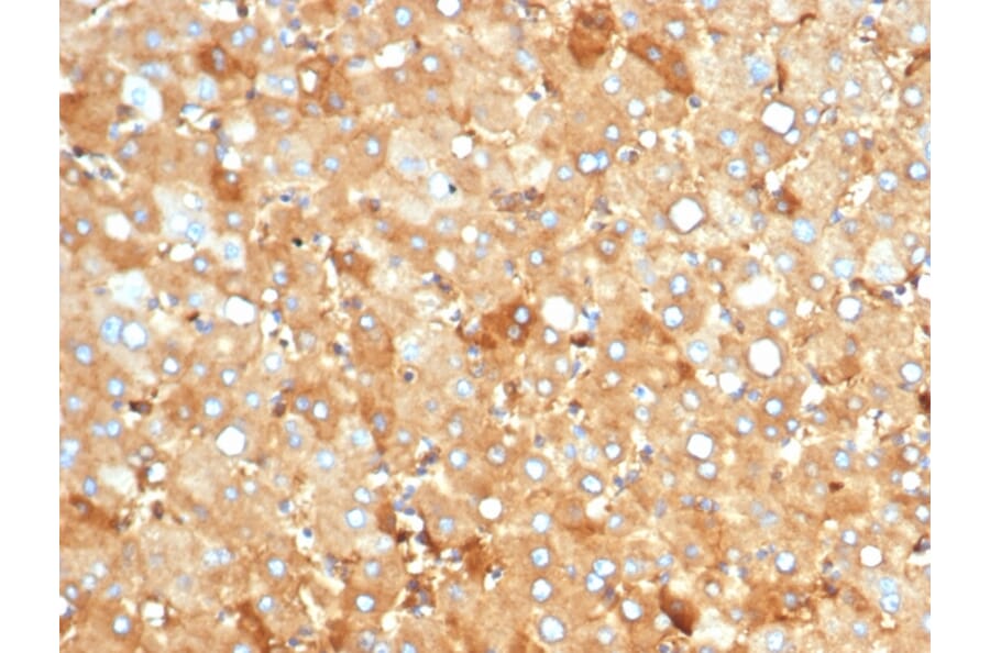 Immunohistochemistry - Anti-Albumin Antibody [rALB/6412] (A248495) - Antibodies.com