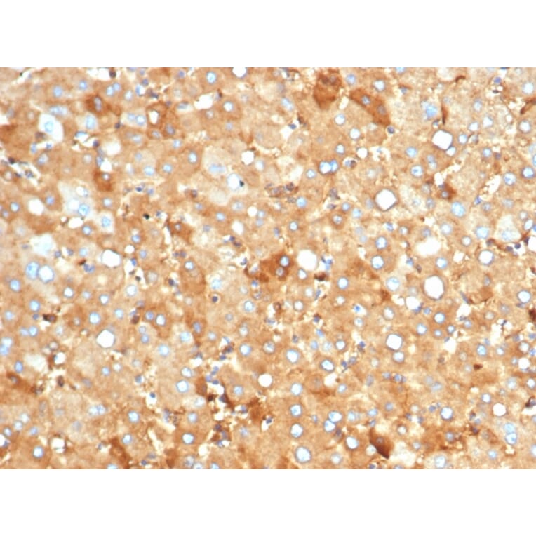 Immunohistochemistry - Anti-Albumin Antibody [rALB/6412] (A248495) - Antibodies.com