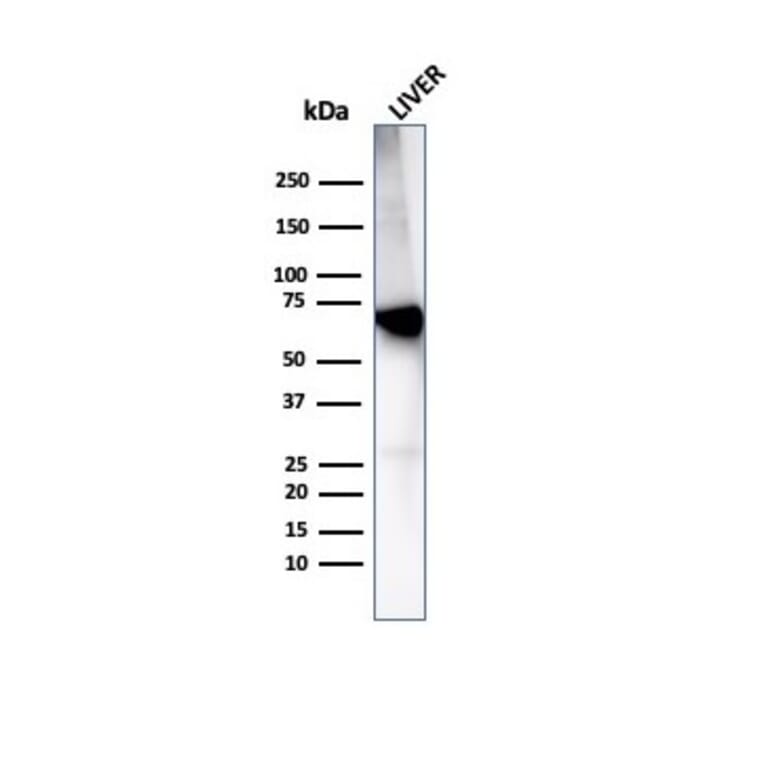 Western Blot - Anti-Albumin Antibody [rALB/6414] (A248497) - Antibodies.com