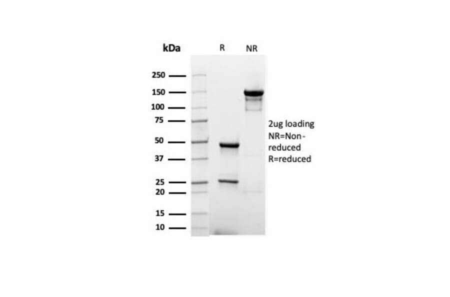 SDS-PAGE - Anti-Albumin Antibody [rALB/6414] (A248497) - Antibodies.com