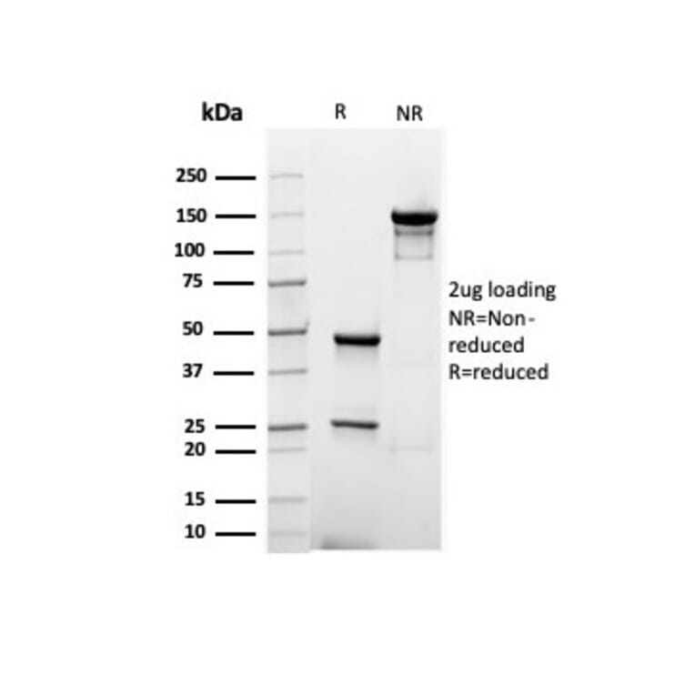 SDS-PAGE - Anti-Albumin Antibody [rALB/6414] (A248497) - Antibodies.com