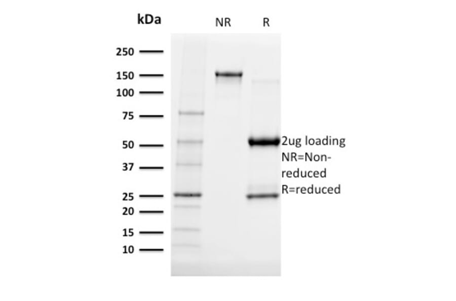 SDS-PAGE - Anti-Albumin Antibody [ALB/2141] (A248498) - Antibodies.com