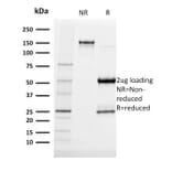SDS-PAGE - Anti-Albumin Antibody [ALB/2141] (A248498) - Antibodies.com