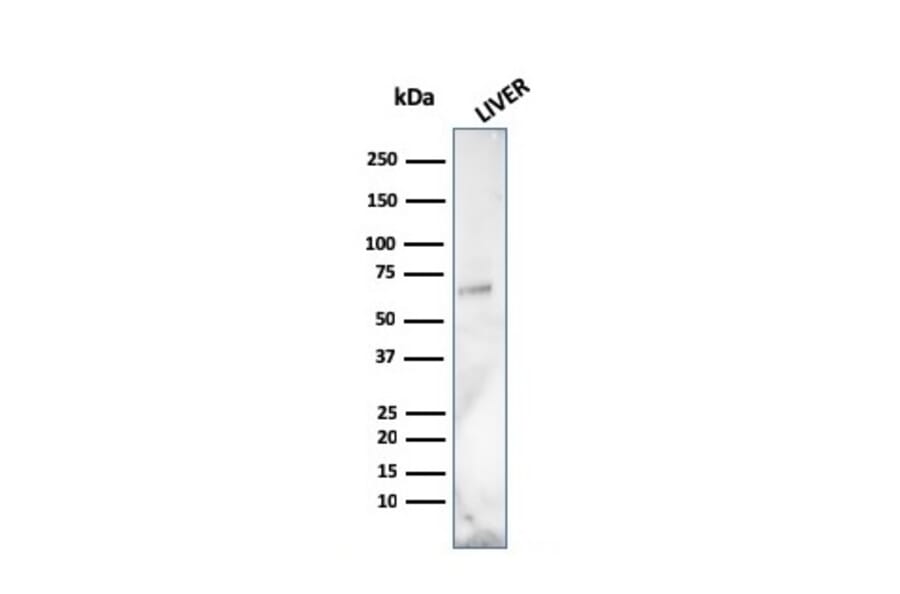 Western Blot - Anti-Albumin Antibody [ALB/2141] (A248498) - Antibodies.com