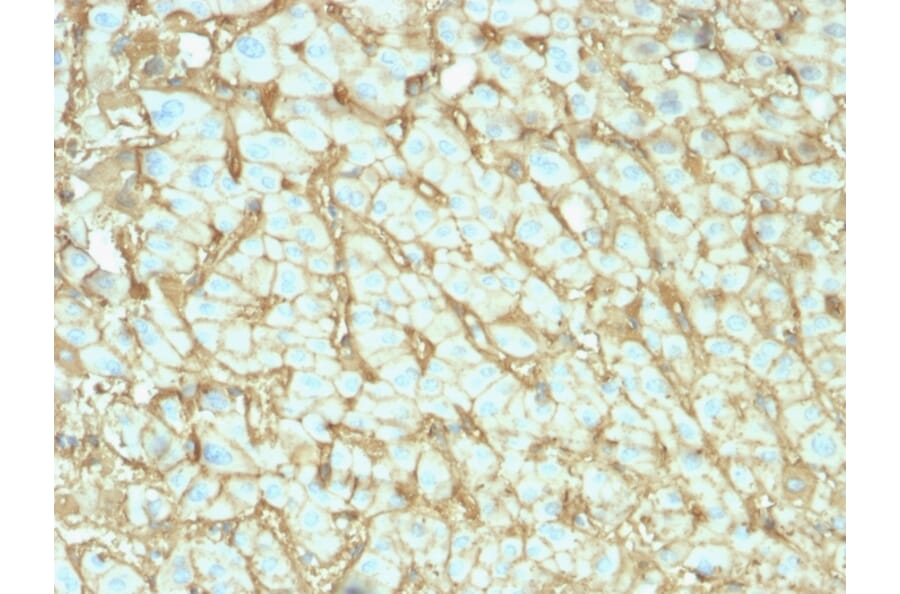 Immunohistochemistry - Anti-Albumin Antibody [ALB/2142] (A248499) - Antibodies.com