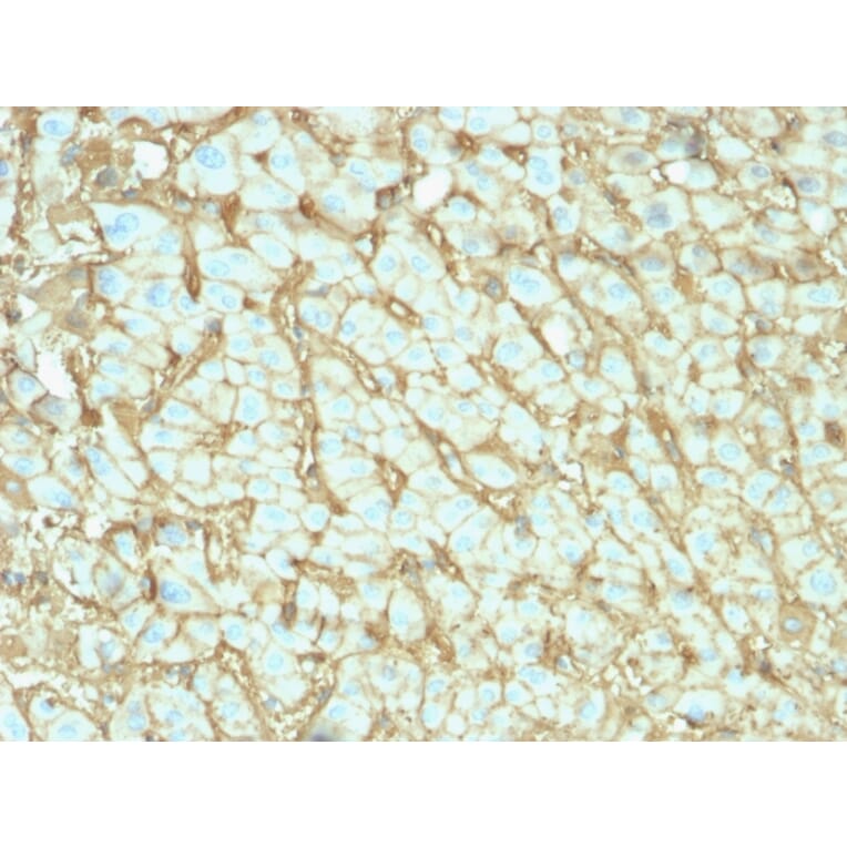 Immunohistochemistry - Anti-Albumin Antibody [ALB/2142] (A248499) - Antibodies.com