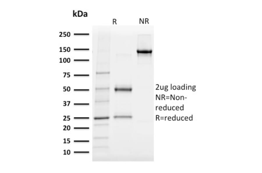 SDS-PAGE - Anti-Albumin Antibody [ALB/2142] (A248499) - Antibodies.com
