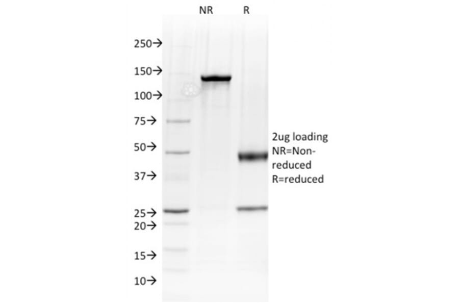 SDS-PAGE - Anti-Albumin Antibody [ALB/2144] (A248500) - Antibodies.com