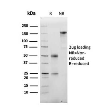 SDS-PAGE - Anti-Albumin Antibody [ALB/2355] (A248501) - Antibodies.com