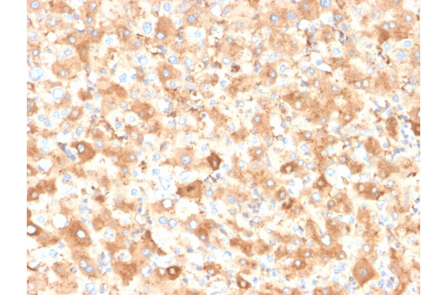 Immunohistochemistry - Anti-Albumin Antibody [ALB/2355] (A248501) - Antibodies.com