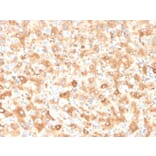 Immunohistochemistry - Anti-Albumin Antibody [ALB/2355] (A248501) - Antibodies.com