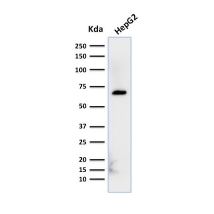 Western Blot - Anti-Albumin Antibody [ALB/2356] (A248502) - Antibodies.com