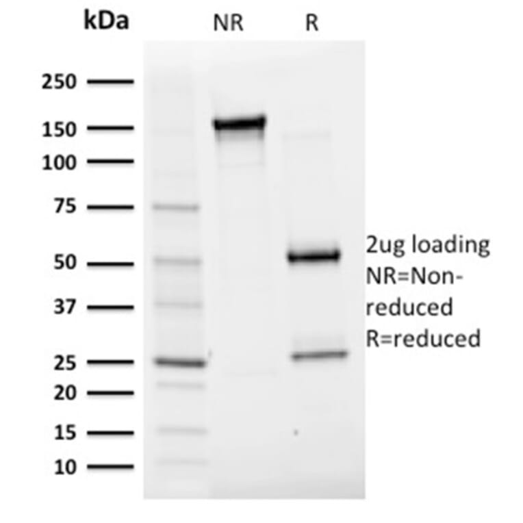 SDS-PAGE - Anti-Albumin Antibody [ALB/2356] (A248502) - Antibodies.com
