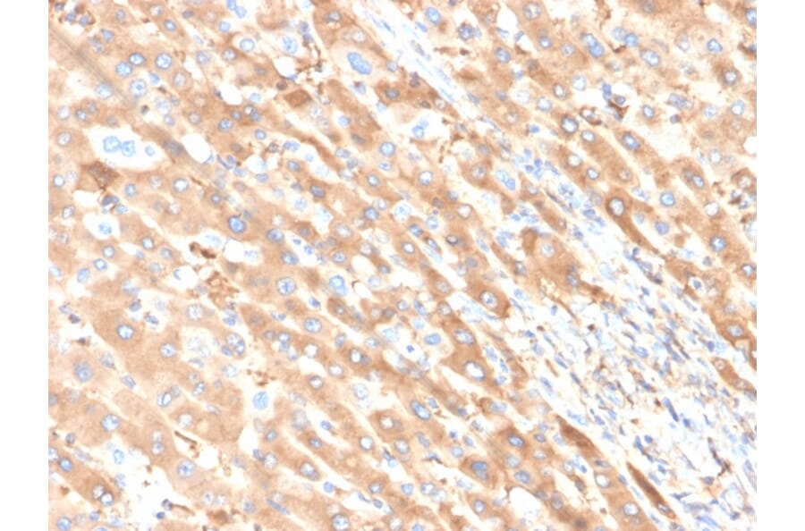 Immunohistochemistry - Anti-Albumin Antibody [ALB/6411R] (A248502) - Antibodies.com