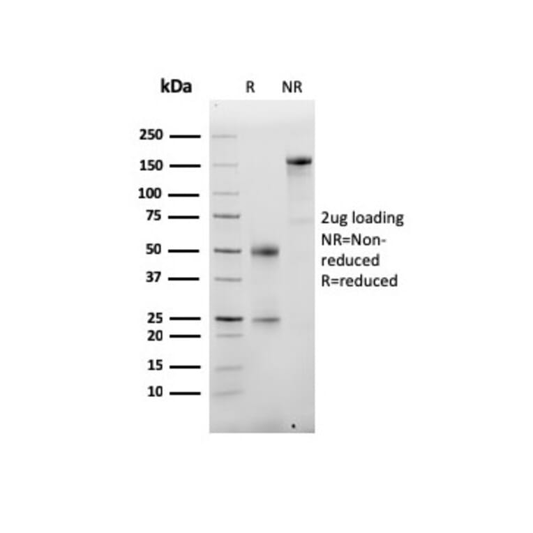 SDS-PAGE - Anti-Albumin Antibody [ALB/6413R] (A248504) - Antibodies.com