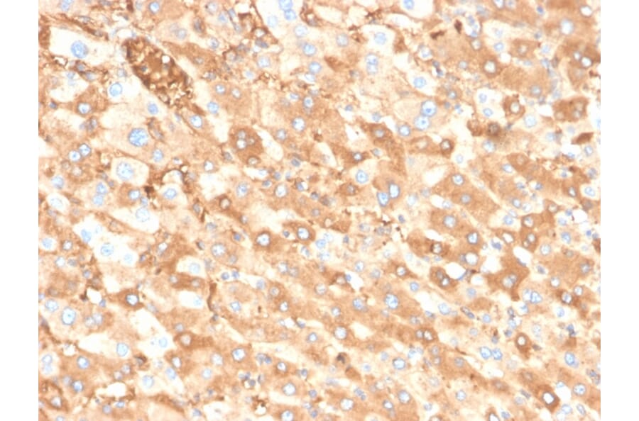 Immunohistochemistry - Anti-Albumin Antibody [ALB/6413R] (A248504) - Antibodies.com